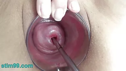 Seorang pria meniduri anal kurus dan dia menunjukkan lubang besar teen sex indo di pantat